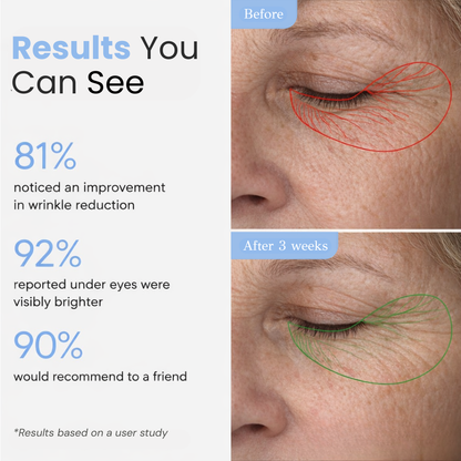 PDRN Infused Face Patches