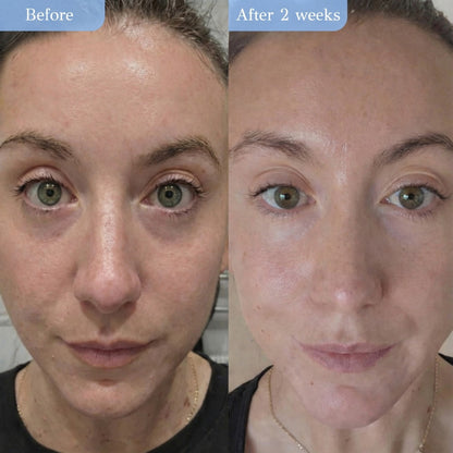 PDRN Infused Face Patches